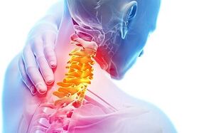 Simptomi cervikalne osteohondroze i pravila prehrane za bolest