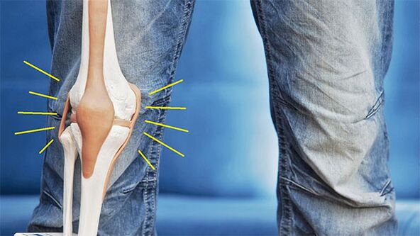 bol u zglobu koljena