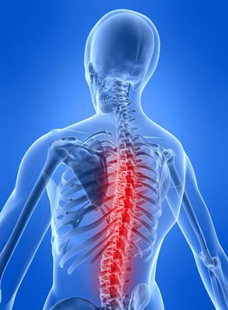 Bol je glavni simptom torakalne osteohondroze